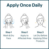 qrxlabs salicylic & glycolic acid pads 2% salicylic & 10% glycolic acne pads for face & bacne with vitamins b5, c, e, calendula, and green tea - 50 count