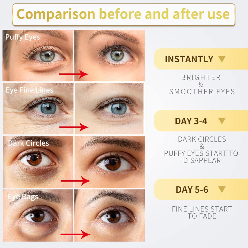 24K gold under eye patches for dark circles, puffiness, and wrinkles care, 60pcs