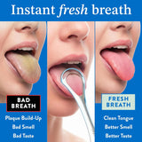 Mouthology 2-pack tongue scraper for adults, metal, stainless steel, tongue cleaner for hygiene