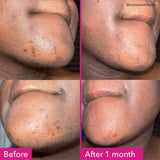 Good Molecules brightening soap free face and body bar with tranexamic kojic acids and niacinamide for dark spots skin care