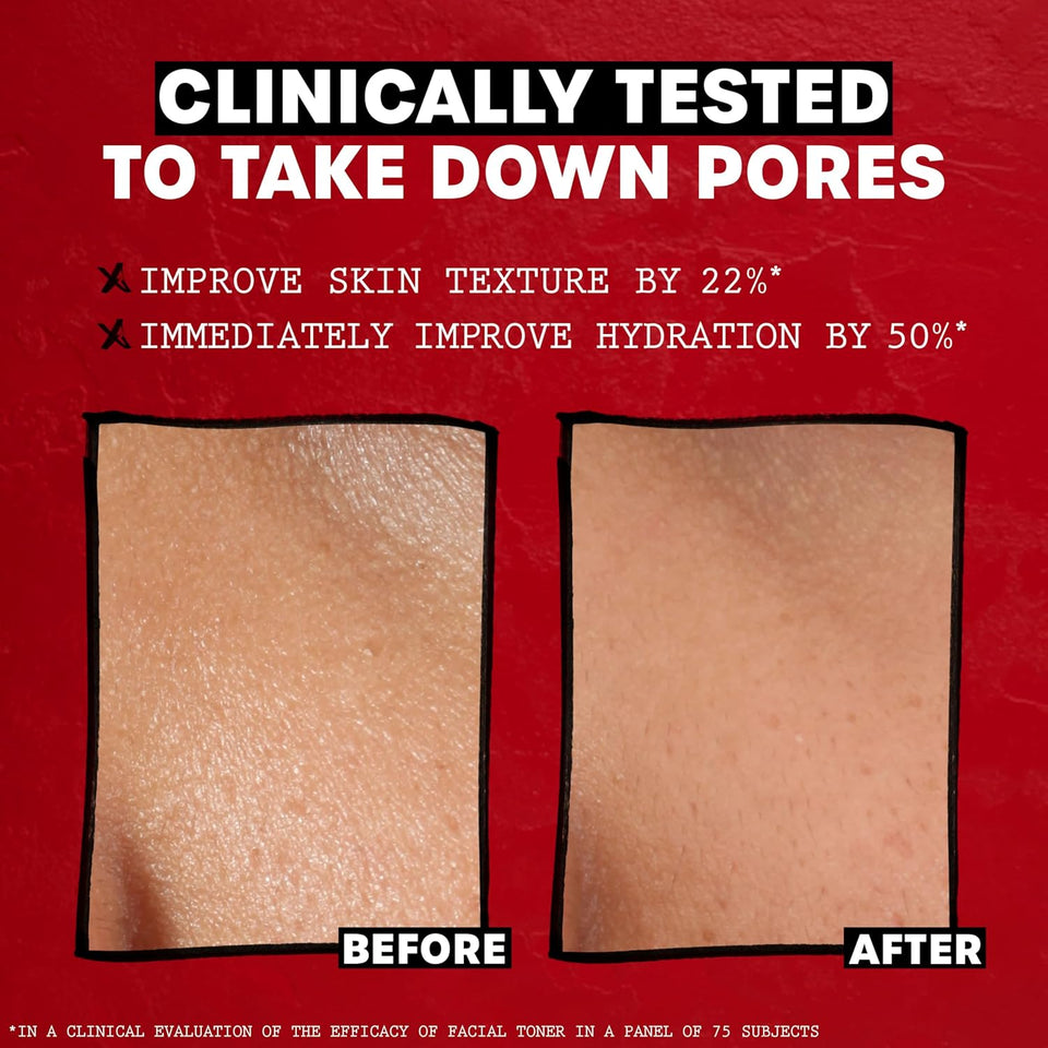 thayers alcohol-free rose petal witch hazel facial toner 12oz soothing hydrating refreshing toner for all skin types