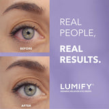 Lumify eye drops for red eyes relief 0.08 fl oz 2.5ml fda approved