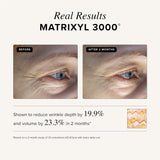Asterwood Triple Repair Serum with Matrixyl 3000, Argireline, Hyaluronic Acid, and Vitamin C for anti-aging and collagen boosting - fragrance-free - 1 fl oz