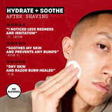 thayers alcohol-free rose petal witch hazel facial toner 12oz soothing hydrating refreshing toner for all skin types